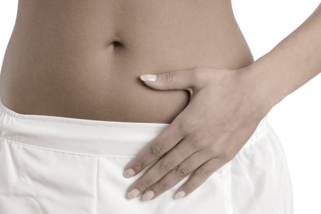 Rimozione mioma uterino in laparotomia